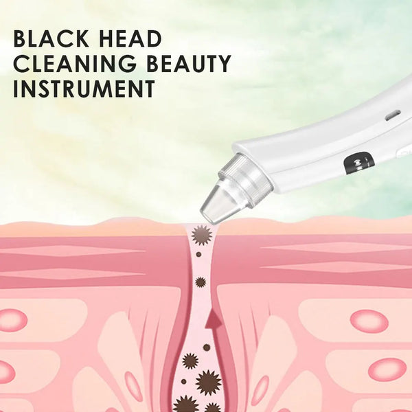 In-Stock-Fast-Drop-Shipping-3-Suction-Mode-Face-Cleansing-Beauty-Machine-Dead-Skin-Remover-Face.jpg