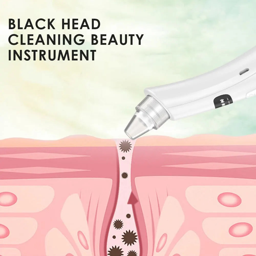 Fresh Glow Skin Vacuum Device